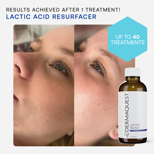 Essentials – Treatment - DermaQuest Clinical